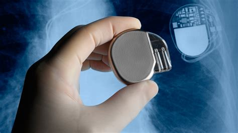 Picture of a Pacemaker